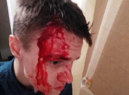 В Киеве жестко избили журналиста зафиксировавшего беспредел КП «Київблагоустрій»